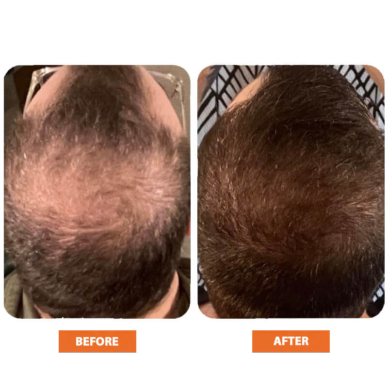 Advanced Root Activator Spray (1 + 1)