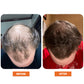 Advanced Root Activator Spray (1 + 1)